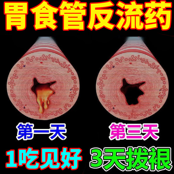 Drugs for stomach heartburn hyperacidity reflux heartburn reflux esophagitis medicine gastroesophageal reflux Chinese medicine pills
