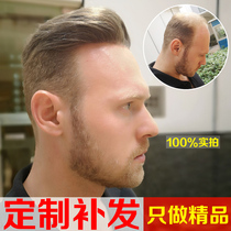 Dawning door-to-door custom wig male woven hair replacement hair increase incognito Korean version of handsome biological scalp head replacement piece