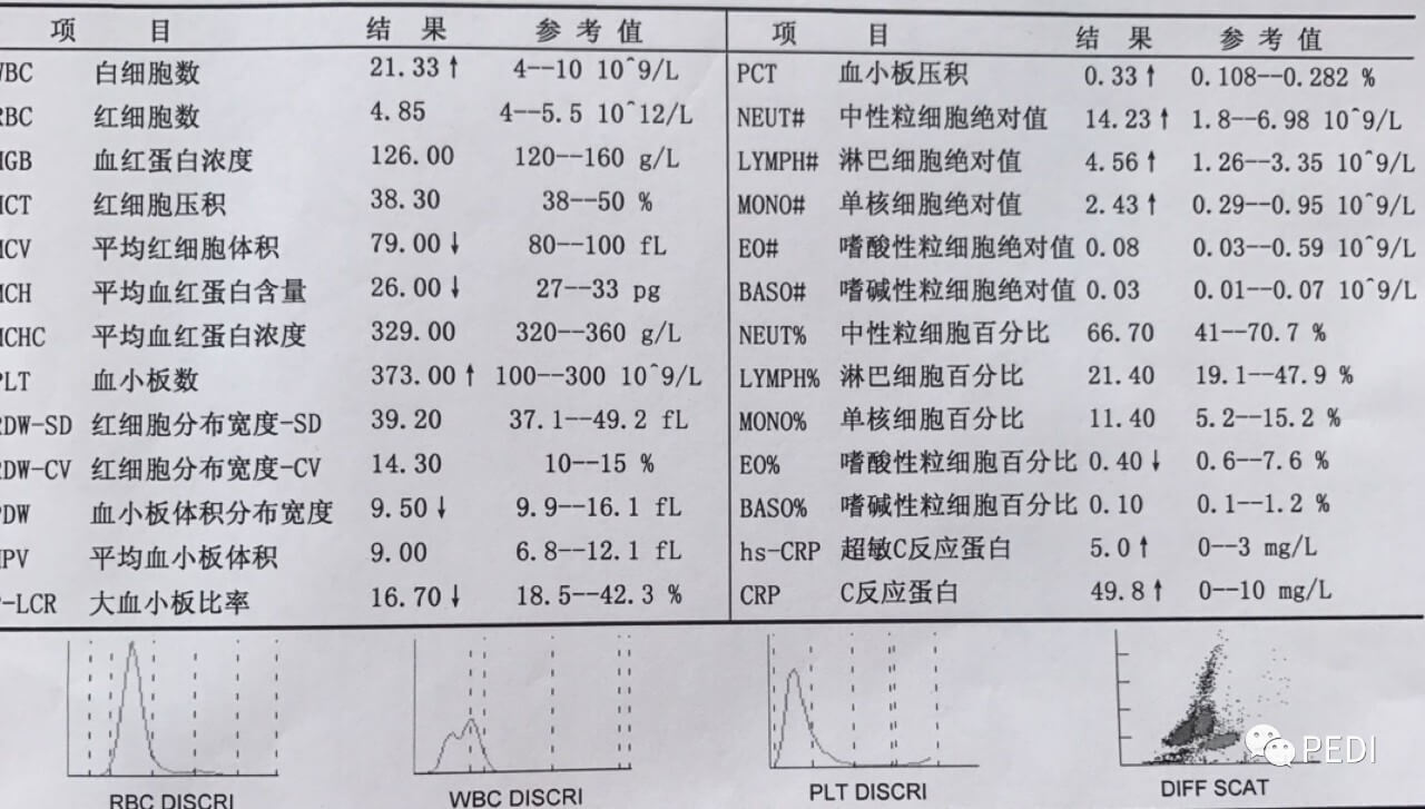 读懂小儿化验单 血常规各项指标代表当前身体状况的意义-图片1