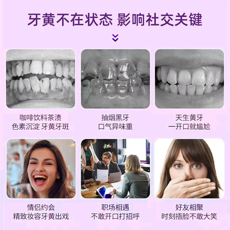 Degaba美牙仪蓝光无线款：用硬核科技，让牙齿白到发亮_电子美牙产品_