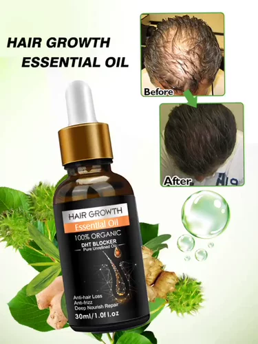 Hairgrowth Kit Carp Care Care Hair Wair Care Wair Mare набор эфирного масла