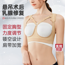 Breast tissue repair after breast augmentation prosthesis fixation and suspension compression corset lifting breast support breast shaping garment