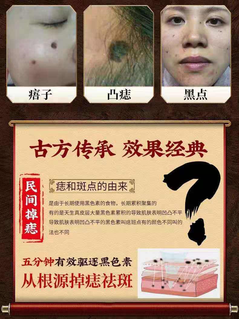 点脸部痣斑药水取雀斑净黑点遗传雀斑无痕美容院专用点痦子痣正品真的有用吗？_化妆_淘宝美妆网