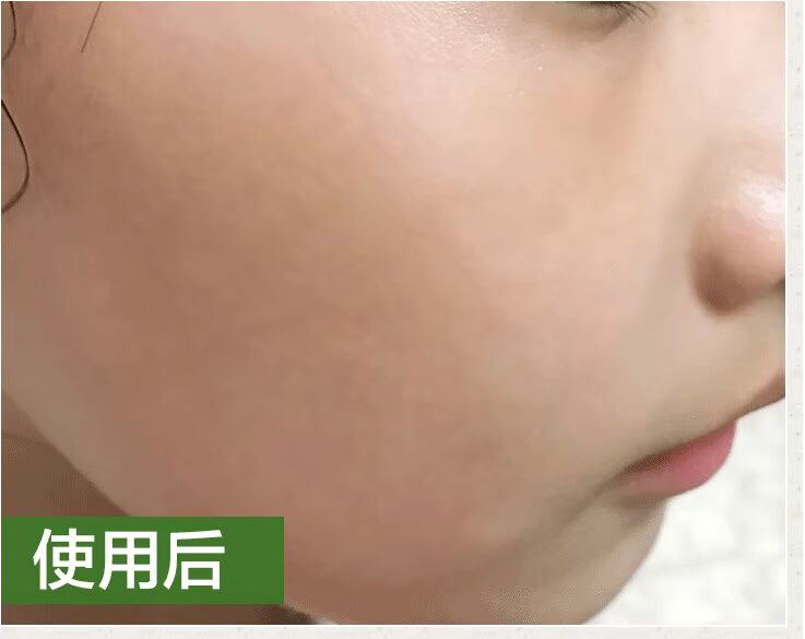 Tinh dầu thực vật nguyên chất dầu hạt nho Dầu nền tinh dầu nguyên chất massage toàn thân mở lại thẩm mỹ viện massage 1000 - Tinh dầu điều trị tinh dầu bưởi mọc tóc