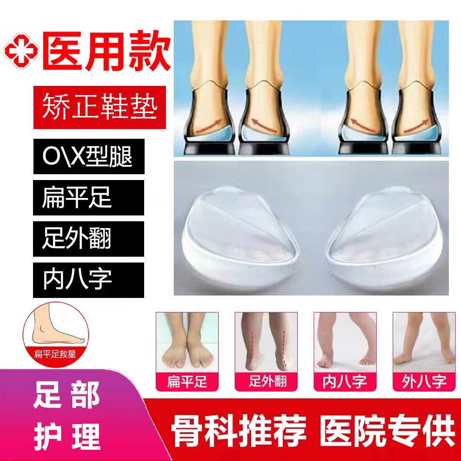 Adult children's foot inversion O-shaped leg X-shaped leg silicone correction insole to correct foot valgus inward eight-character outer eight-character pad