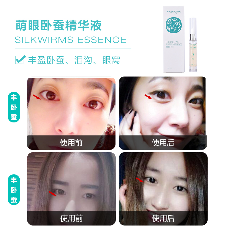 Huimei Fang Feng Sleeper essence Feng's forehead Go to bag eyesdrop Recessed Filling Tear Ditch Essential Oils free of washing 12 ml