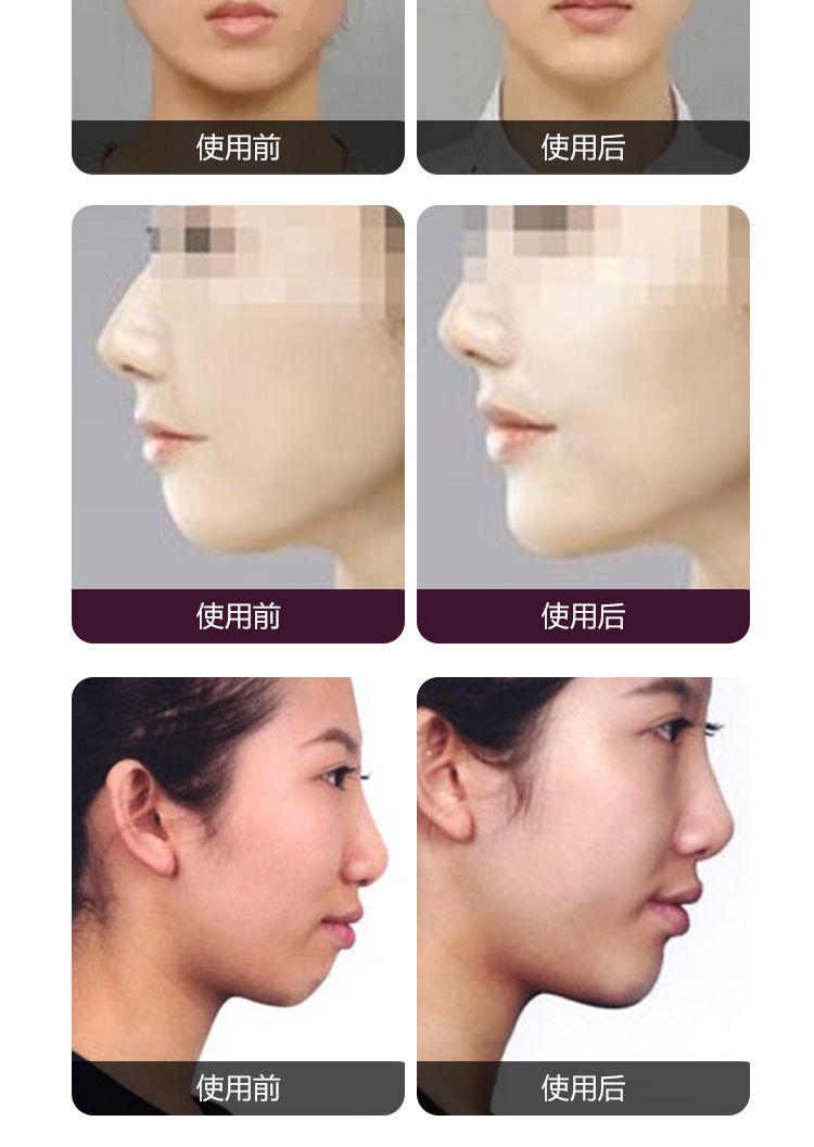 Feng chin tinh dầu cằm làm sắc nét lâu dài chỉnh sửa cằm ngắn rút lại tăng trưởng tạo tác đích thực - Tinh dầu điều trị tinh dầu húng chanh minion