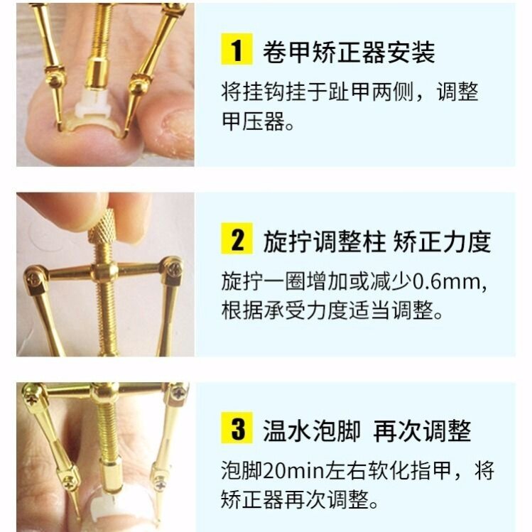 Machiodontitis straightener machiodylitis special instrumental insert for nail clippers with nail clippers for nail-clippers