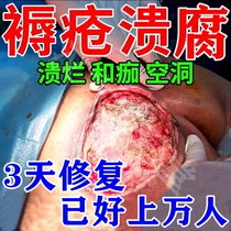 Decubitus ointment for the elderly removes putrefaction and promotes muscle regeneration to promote wound scab healing. It is an external ointment for old rotten legs and buttocks.