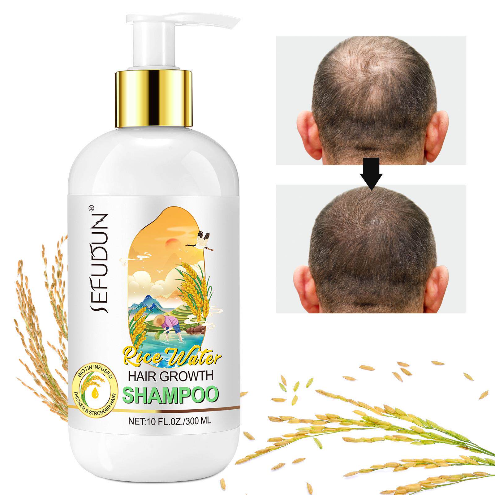 товар из китая rice water shampoo conditioner hair growth shampoo condition