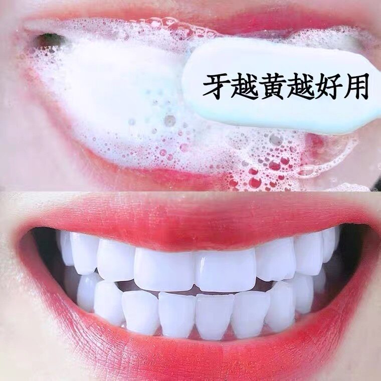 Buy 2 get 1 free (white teeth are more beautiful) teeth yellowing to remove calculus smoke stains tea stains unisex yellow tooth artifact