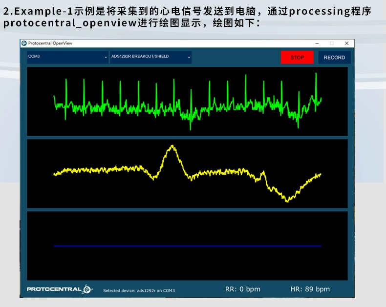 ADS1292 mô-đun ECG cảm biến điện tâm đồ kênh đôi theo dõi hô hấp thu thập nhịp tim 20 bảng phát triển cạnh tranh điện tử