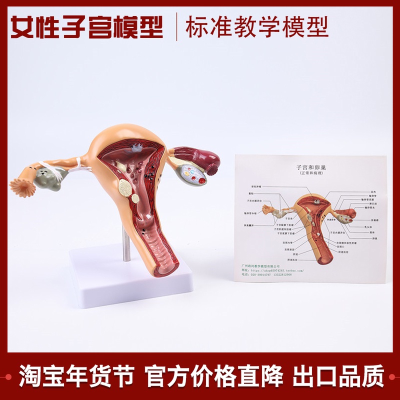 Factory price direct selling female internal and external genitalia anatomy model ovary uterus contraceptive guidance model family planning model