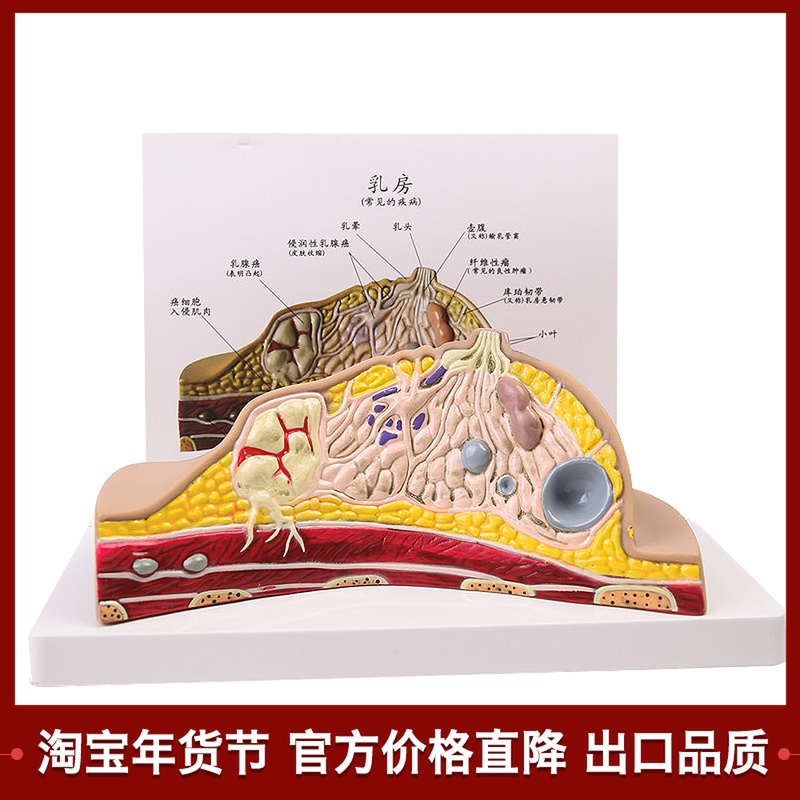 Gynecological Breast Anatomy Model Breast Common Diseases Breast Pathological Anatomy Breast Structure Model