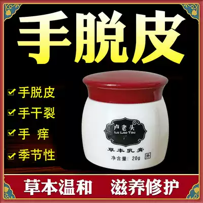 Hand peeling, small blisters, hand itching, blisters, peeling, chapped, seasonal hand Qi, itching cream, skin itching