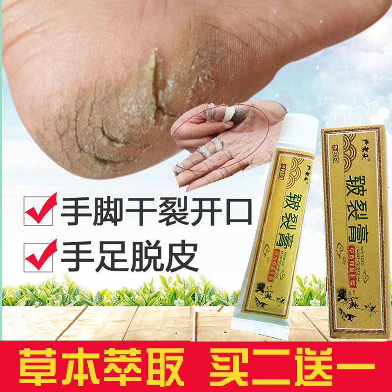 Old man Lu's chapped cream treats dry and cracked heels, hands and feet cracks, hands and feet anti-cracking turtle cream, hands and feet cracking and peeling