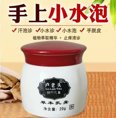 Hand itching blisters, peeling, dry hands, small blisters, fingers, peeling, dry seasonal anti-itching cream