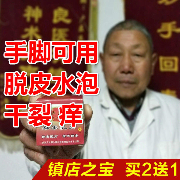 Foot Itch Cream Reflexology Foot Girl Feet Girl Feet With Blisters Toe Stitches Peeling Cracking Palm Metamorphoa