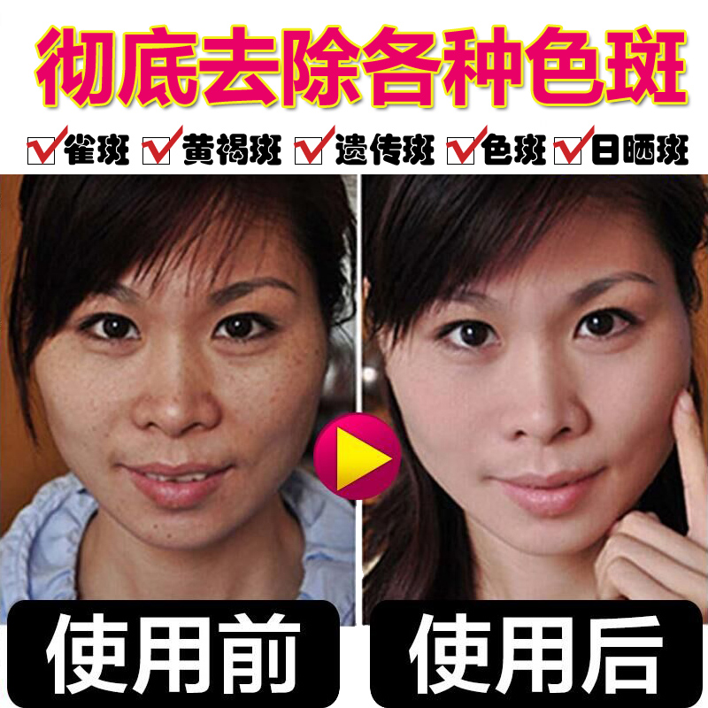 Snail Discover Wash Wheel Men Moisturizing and Mamming Deep Cleaning Whitening and Downing Painting Spot