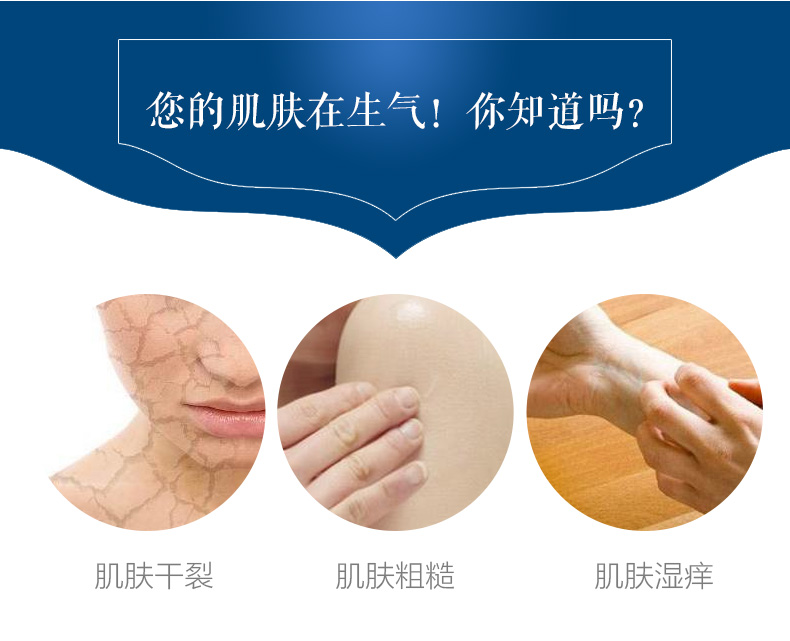 Ice King Kem Kem Da Khô Ngứa Chống ngứa Kem Body Lotion Body Lotion Dưỡng Ẩm Chăm Sóc Cơ Thể Chính Hãng sữa tắm en chen tơ