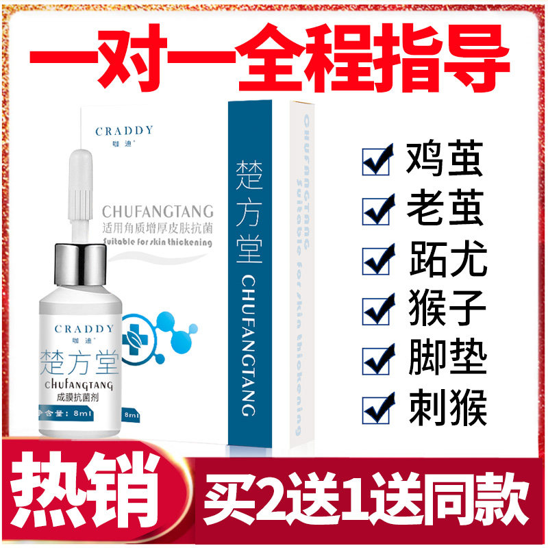 Kadi Chu Fangtang Corns paste TOENYULINGJING calluses Monkey foot pads Flesh thorn Hands and feet Soles of feet