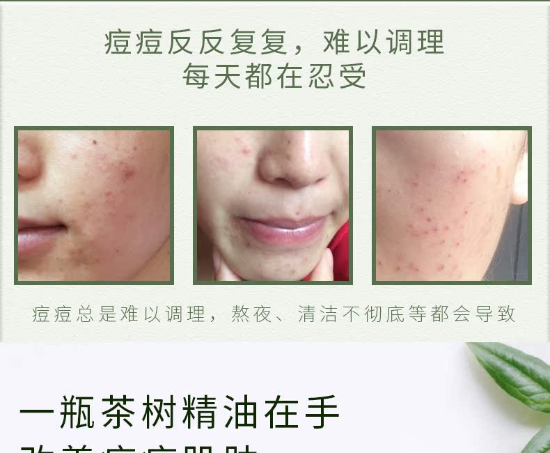Zhongcao trà cây hợp chất tinh dầu 10ml giúp cải thiện lỗ chân lông thu nhỏ làm dịu da sửa chữa tinh dầu thơm - Tinh dầu điều trị tinh dầu hoa bưởi