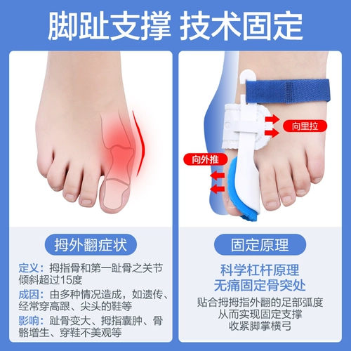 Активатор переполнения большого пальца активатор мужского пола Женщины с большим пальцем, большие ноги могут носить обувь, улучшить улучшение, правильное, правильное разделение