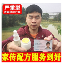 Order for rhinitis and get 5 yuan off. It can be used by both adults and children.