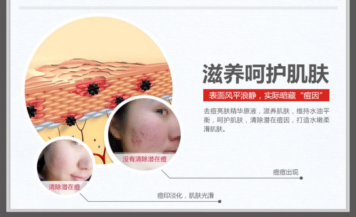Tinh chất trị mụn Boquanya tinh dầu dưỡng ẩm kiểm soát nam giới và phụ nữ chăm sóc da mặt tinh chất sản phẩm chăm sóc da sum 37 vàng