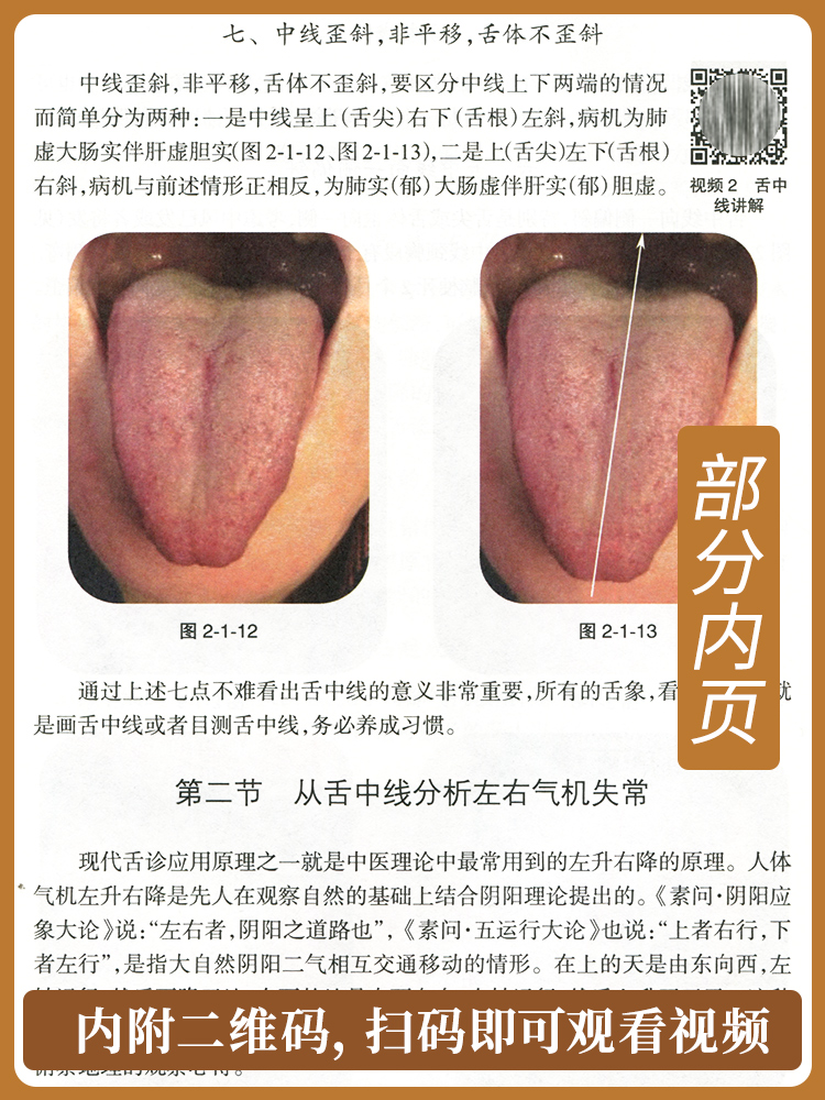 🌿中医舌诊新发现！《殷氏现代舌诊原理与图谱》带你走进舌诊世界