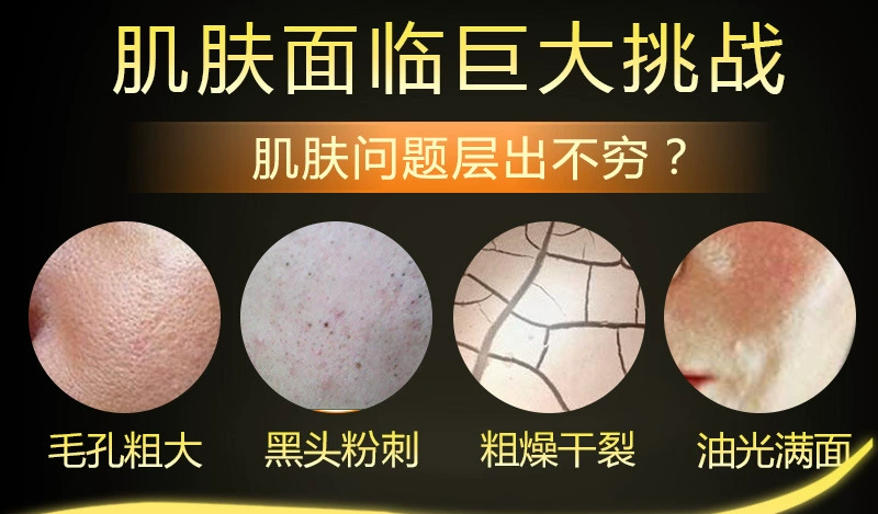 露露 黑 面膜 Cải thiện mặt nạ sửa chữa phục hồi dưỡng ẩm 10 miếng đóng hộp - Mặt nạ