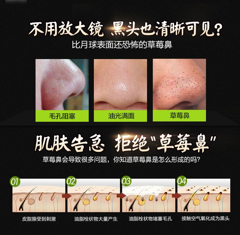 Hàn Quốc cho bé mặt nạ đen kiểm soát dầu để trị mụn đầu đen làm se khít lỗ chân lông - Mặt nạ