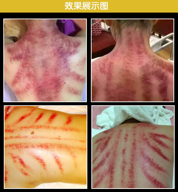 中医负压排酸仪 平衡排酸仪 美容院养生仪器