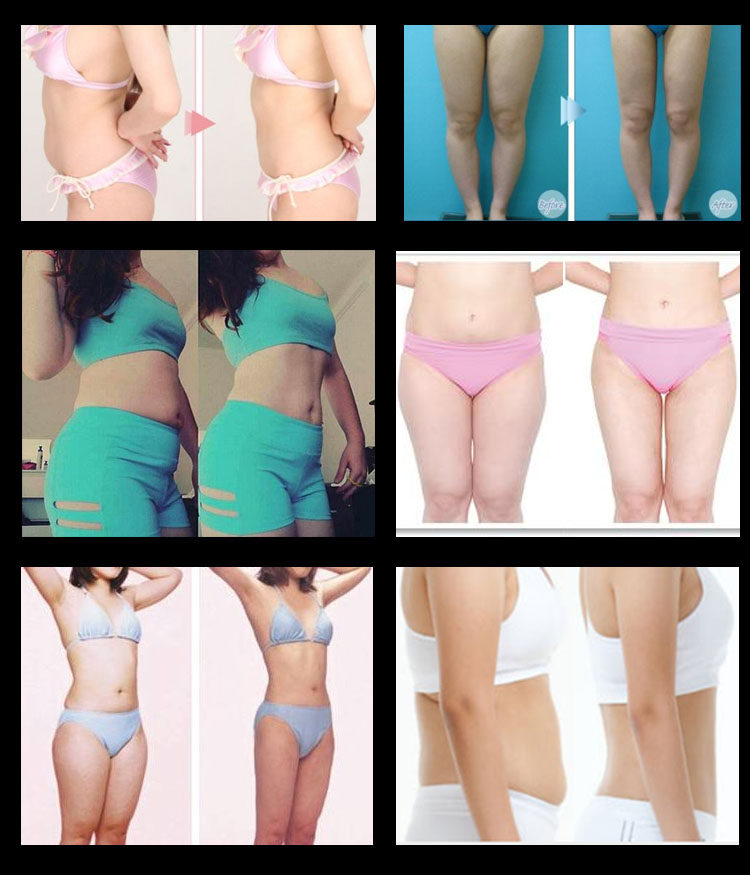 中医负压排酸仪 平衡排酸仪 美容院养生仪器