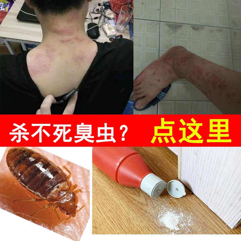 Bed bug nemesis bed artifact insecticide anti-bed bug medicine special medicine net pesticide medicine powder bed bugs to remove bed bugs