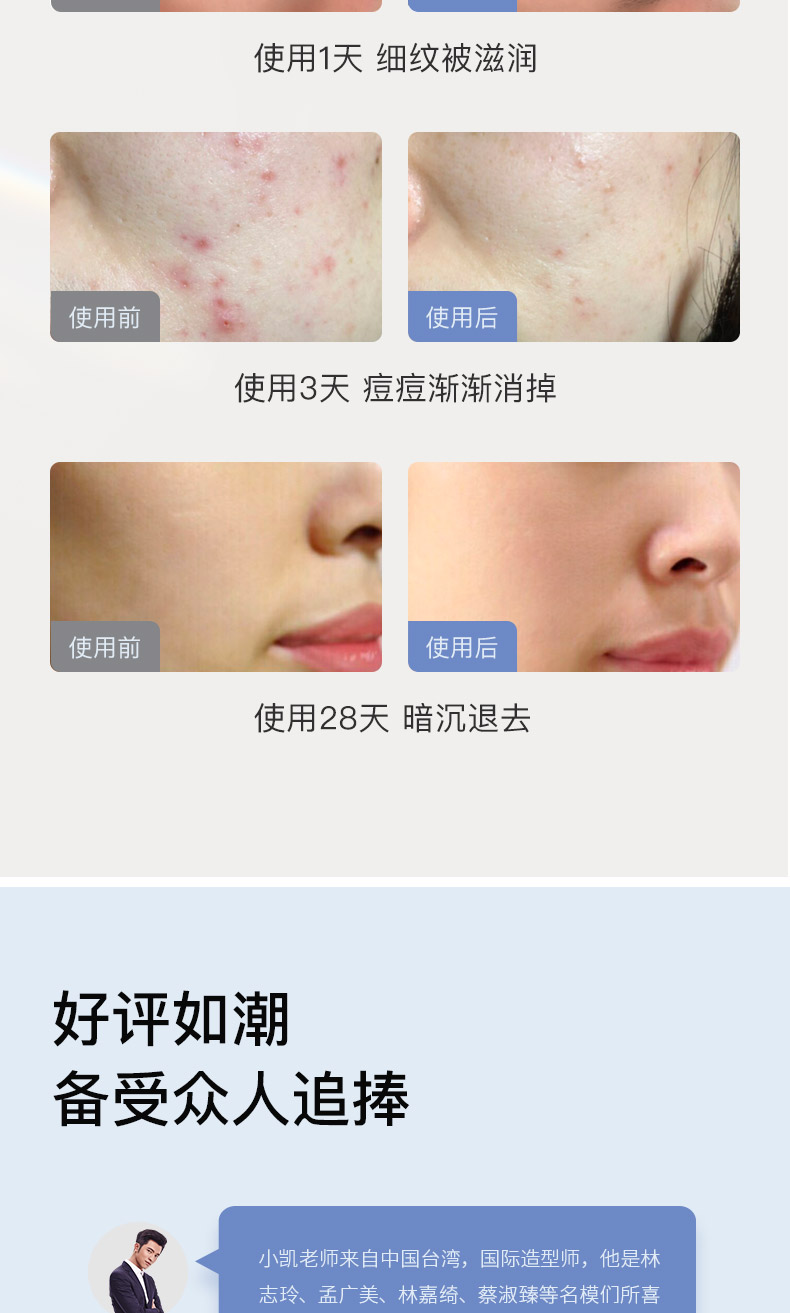 日本 Cosbeauty可思美 射频胶原蛋白再生童颜机 多功能导入仪 图4
