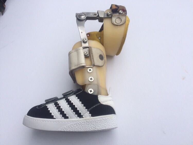 Children's Knee, Ankle, and Foot Orthotics Corrective Shoes Foot Support Velcro Leather Fabric Spring and Autumn Style Single Shoes Outerwear Shoes