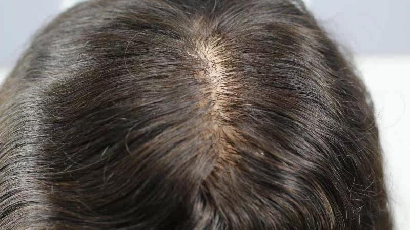 Extension mèches - Ref 218115 Image 15