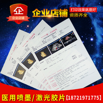 Hospital-use color ultrasound film porcelain white inkjet translucent laser film gastrointestinal endoscopy color four-dimensional B-ultrasound printing paper