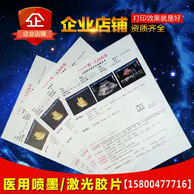 Hospital color ultrasound negatives Porcelain white inkjet translucent laser negatives Gastroenteroscope color four-dimensional B ultrasound photocopying paper