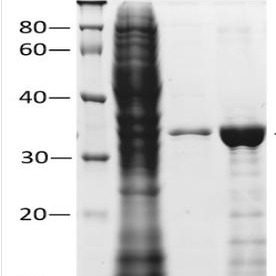 His(HHHHHH)-tagged Protein Purification 融合蛋白纯化试剂盒