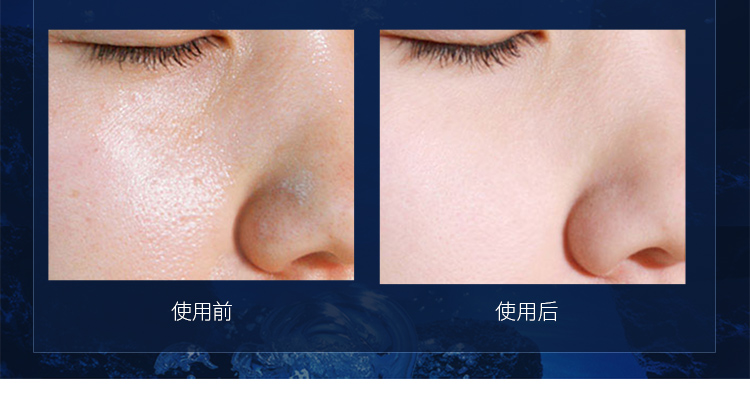 BOB chính hãng phấn phủ trang điểm lâu trôi kiểm soát dầu lỗ chân lông vô hình che khuyết điểm khả năng sửa chữa nền tảng ướt và khô bột cá phấn shiseido
