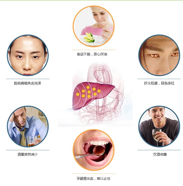 Mua hai tặng hai viên nang mềm gốc Gegen nam và nữ sản phẩm sức khỏe không dùng thuốc hỗ trợ bảo vệ tổn thương gan do hóa chất - Thực phẩm dinh dưỡng trong nước viên uống vitamin tổng hợp