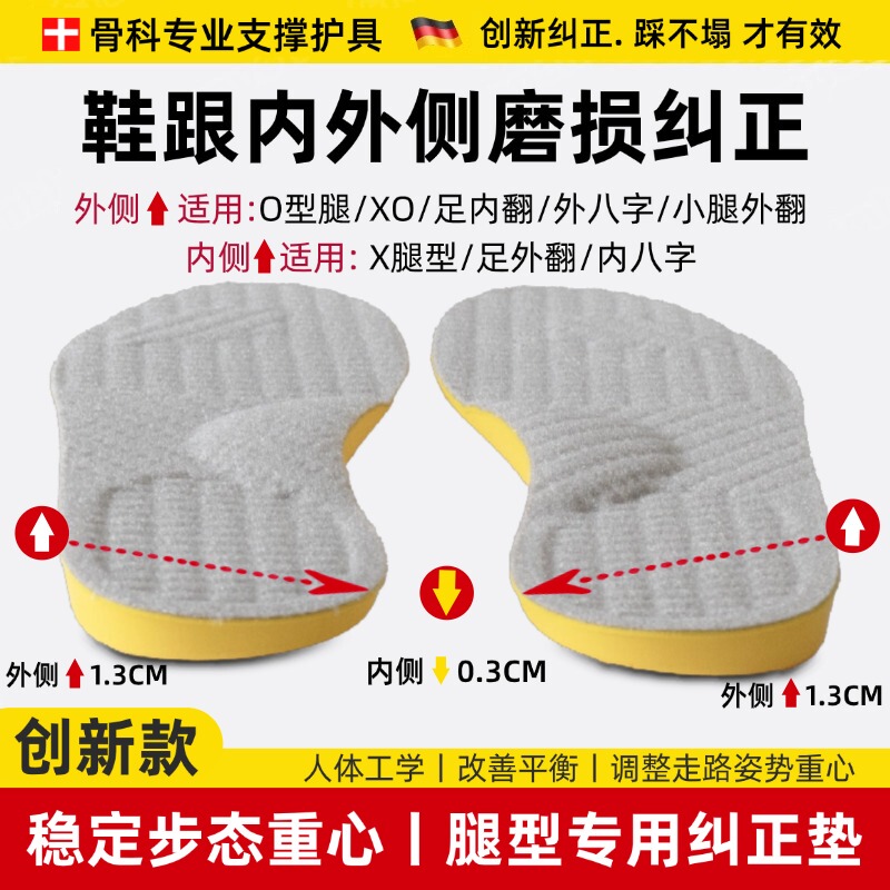 O-Shaped Leg Insoles Correct Foot Pronation, Flat Arches, Calf Valgus, and Outer Foot Wear; a Tool for Adults with Splayed Feet O-Shaped Leg Insoles Correct Foot Pronation, Flat Arches, Calf Valgus, and Outer Foot Wear; a Tool for Adults with Splayed Feet