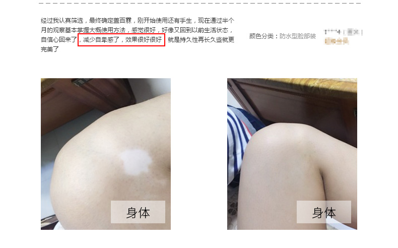 Gai Bai Lin Trắng Tại Chỗ Bao Gồm Lỏng Không Thấm Nước Vitiligo Bao Gồm Chất Lỏng Không Thấm Nước Kem Che Khuyết Điểm Bao Gồm Kem 30 ml
