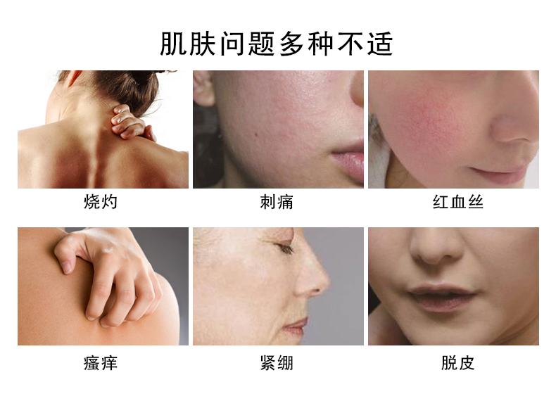 Posay Quante So nhẹ Cream 40ml Kem dưỡng ẩm Lotion Kem chăm sóc da Làm dịu nhẹ sửa chữa cơ bắp nhạy cảm - Kem dưỡng da kem dưỡng da mụn