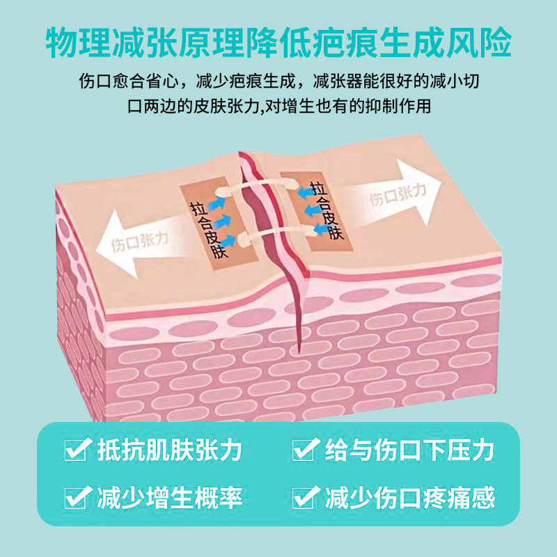 Jela Medical Skin Tension Reducer Suture Device Wound Reduction Patch Caesarean Section Scar Wound Tape No-Stitch Adhesive Tape Fn