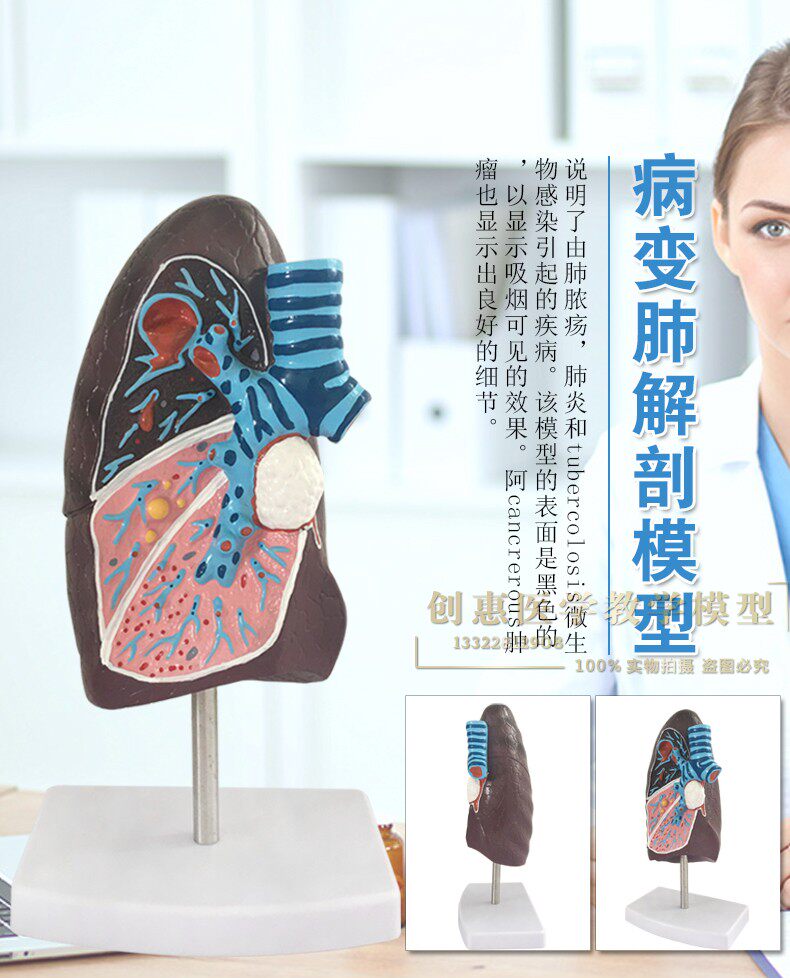 肺模型医药礼品肺解剖模型 肺段模型 呼吸科肺模型 肺结构模型