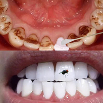 (White teeth don’t ask for help) White teeth are more beautiful. The nemesis of tobacco-stained tea teeth. Easily get white teeth. A must-have for lazy people.