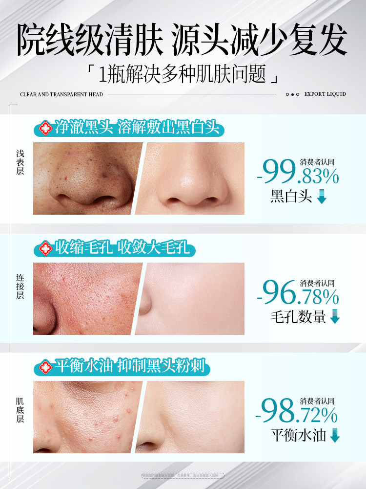 Blackhead Removal Liquid, Deep Cleansing Acne Shrink Pore Nasal Patch, Men's and Women's Beauty Salon Special Tool, Blackhead Water